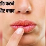 #WinterCare #SoftLips #LipCareTips #HealthyLips #BeautyTips #HydrationTips