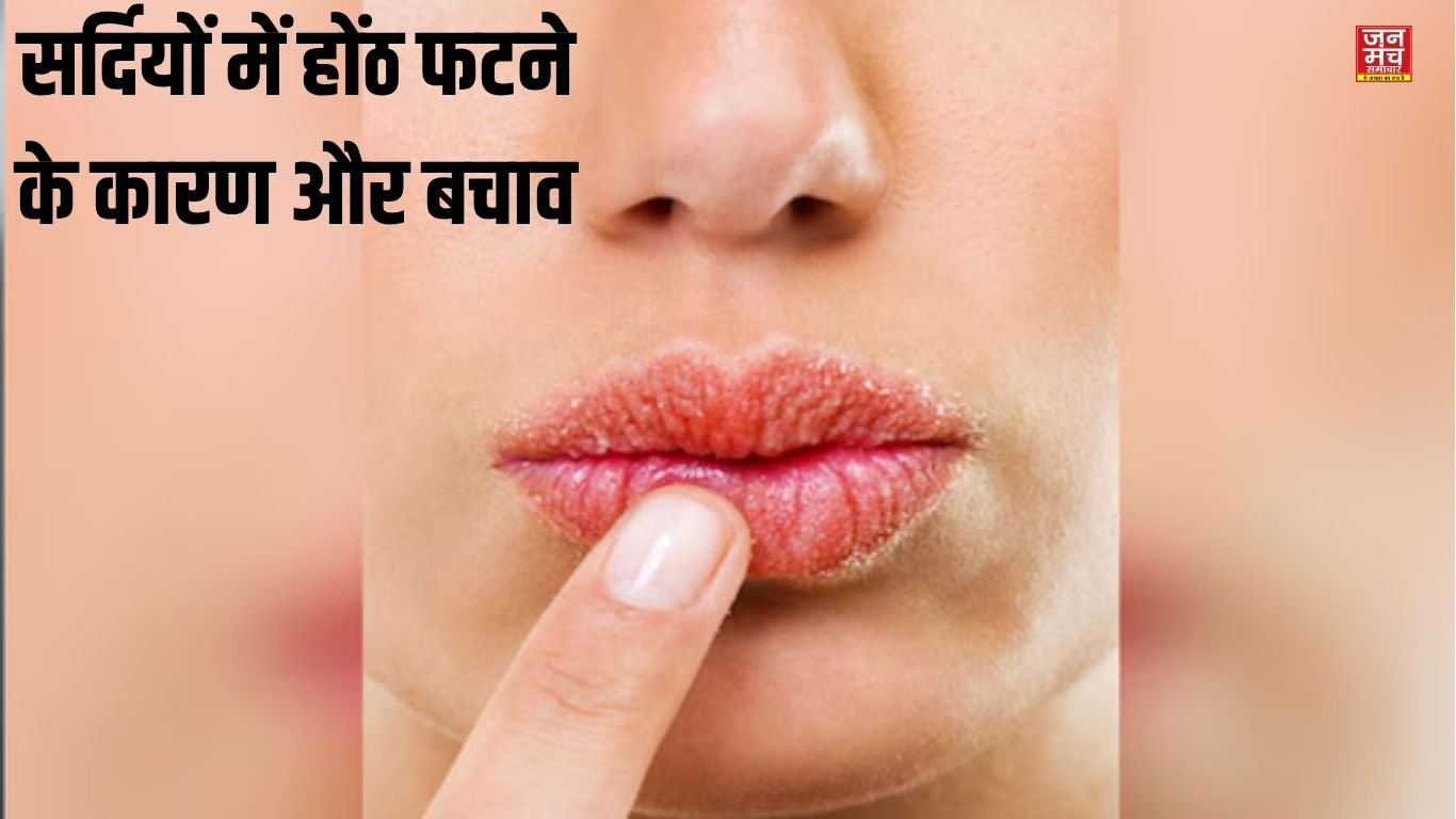 #WinterCare #SoftLips #LipCareTips #HealthyLips #BeautyTips #HydrationTips